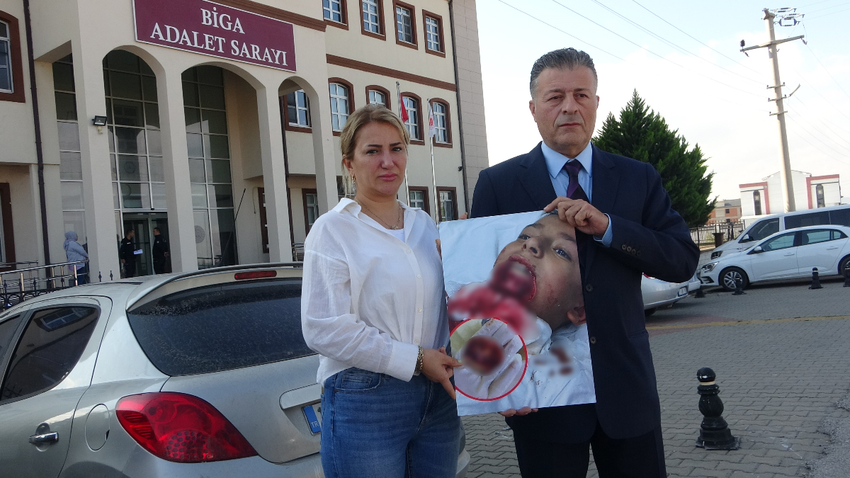 canakkalede okulda ogrencinin cenesi koptu okul sorumluluk kabul etmedi BYLZfcxE.jpg