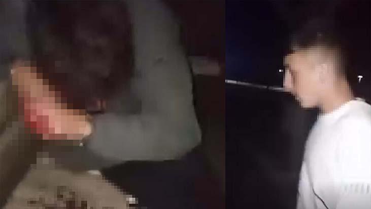 lise ogrencileri arasinda kanli kavga arkadasini parka cagirarak darbetti yS1pemuE