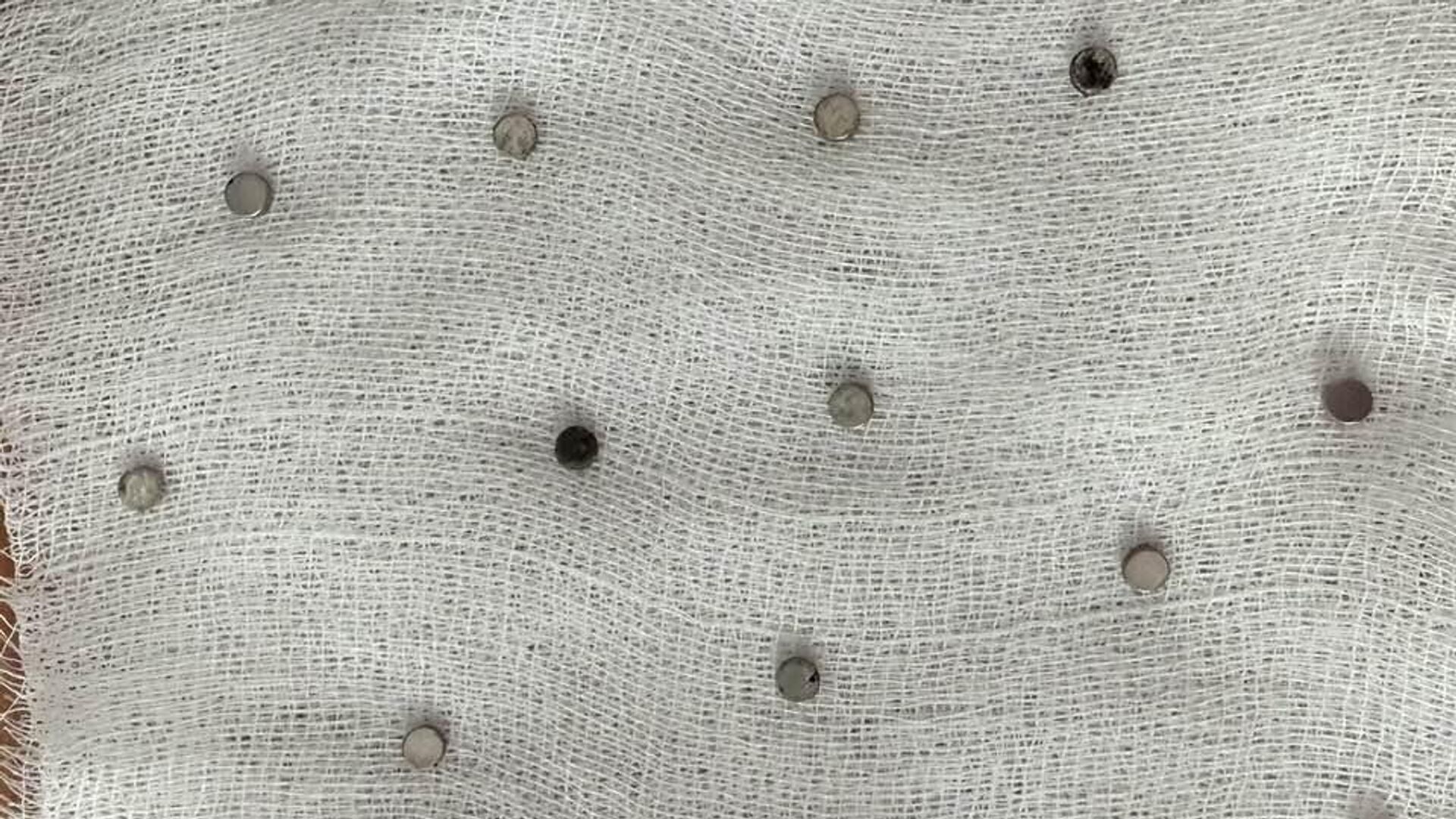 toplam 19 miknatis yemek borusundan cikarildi TigY59W4